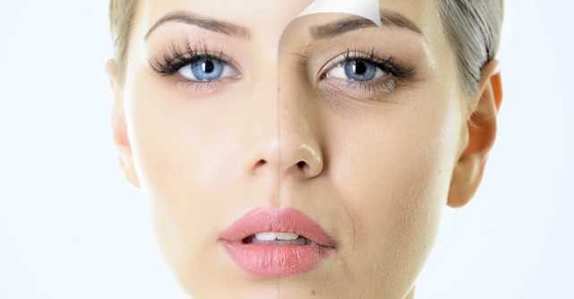 Scapa de riduri prin dieta