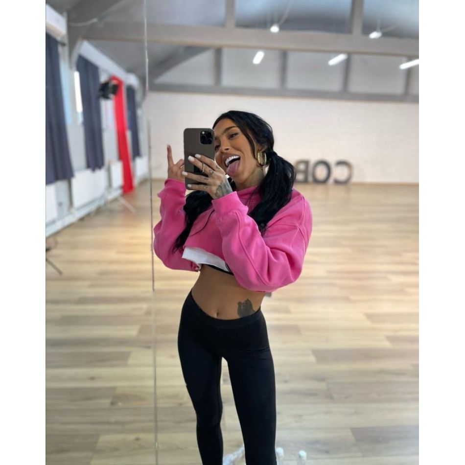 Ruby, plină din cap până în picioare de vânătăi! Cine a putut să îi facă așa ceva artistei?!