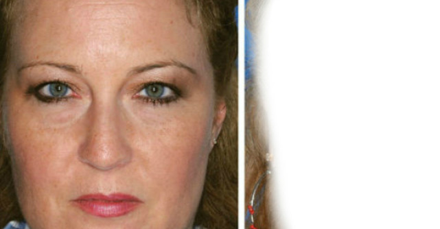 Foto: Efectele fumatului asupra pielii tale! Imaginile spun totul!