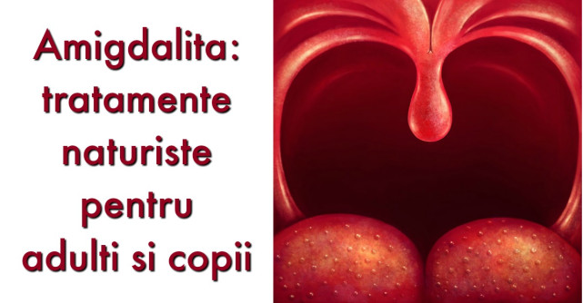 Amigdalita - tratamente naturiste eficiente