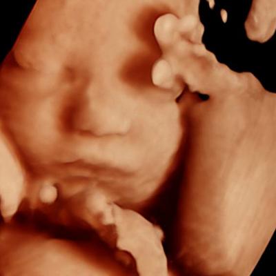 Ecografiile de morfolgie fetală 3D/4D: ce ar trebui să știe viitoarea mămică?