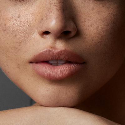 Pistruii falși – artificiul estival care îți aduce farmecul inocent al verii pe chip