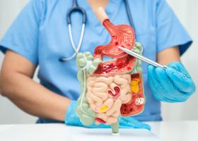 Arsuri la stomac sau reflux gastroesofagian (BRGE): de la simptome si cauze la remedii si tratamente