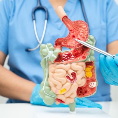 Tot ce trebuie să știi despre refluxul gastroesofagian: cauze, diagnostic, dietă și tratament