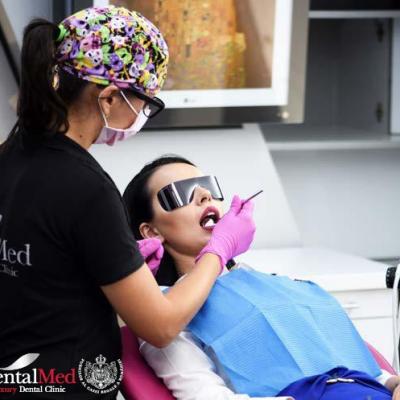 10 întrebări și răspunsuri despre detartrajul dentar