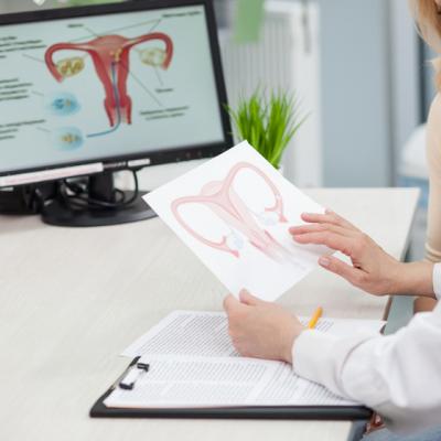 Fibromul uterin - problema care afecteaza tinerele femei
