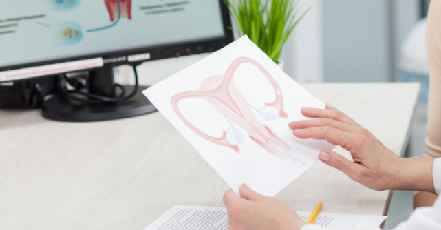 Fibromul uterin - problema care afecteaza tinerele femei