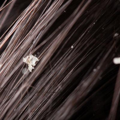 Pont! Cum scapi de matreata