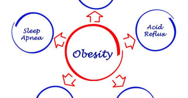 Primul document consens despre obezitate si stil de viata sedentar 