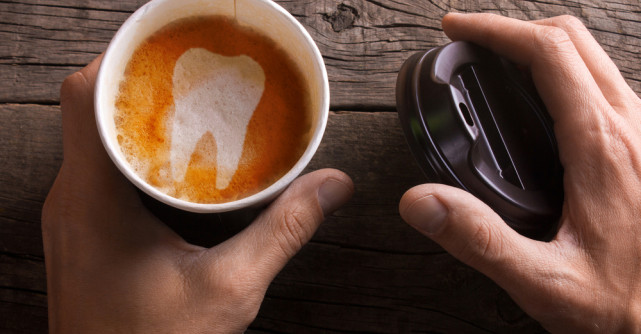 Secretul dinților albi. Ce trebuie să faci ca să-i ai?