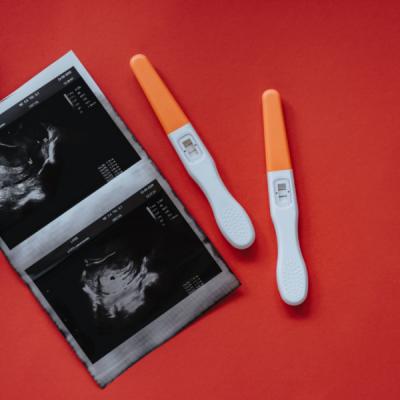 Cinci sfaturi pentru a te pregăti corect pentru o ecografie morfologică 