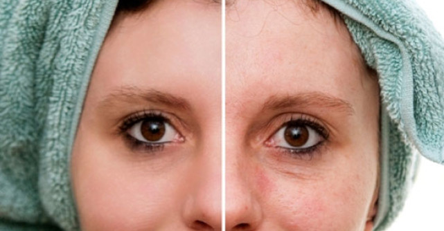 FUNCTIONEAZA: Trucul uimitor de a-ti scoate punctele negre de pe fata!