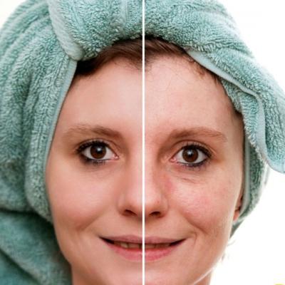 FUNCTIONEAZA: Trucul uimitor de a-ti scoate punctele negre de pe fata!