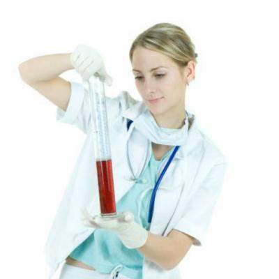 Analize medicale explicate: Ce este VSH-ul?