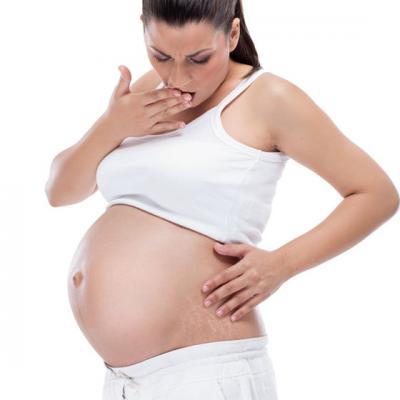 Vergeturile si sarcina: Ce trebuie sa stii pentru a le evita