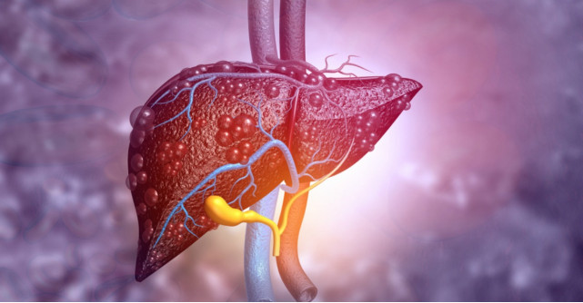 Tot ce trebuie sa stii despre ficatul gras: cauze, simptome si tratament