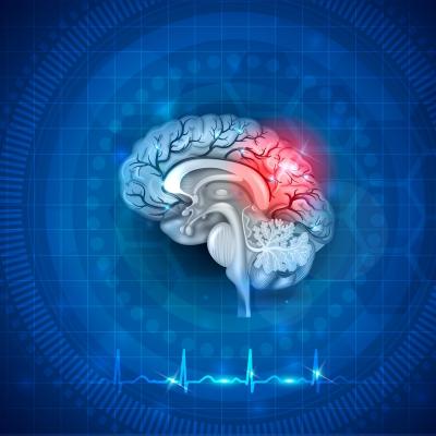 Tot ce trebuie sa stii despre hematomul subdural: tipuri, cauze, simptome si tratament