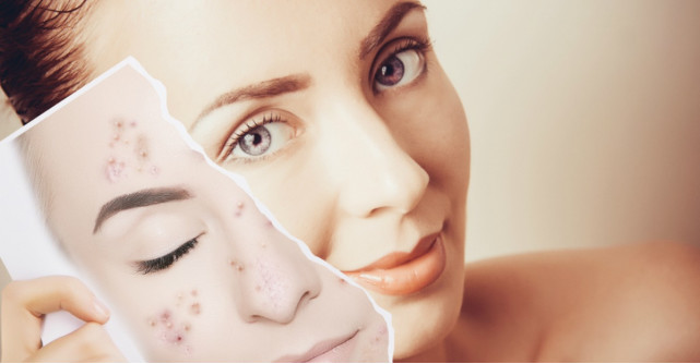 Stafilococul auriu: simptome, cauze si ce pericole ascunde