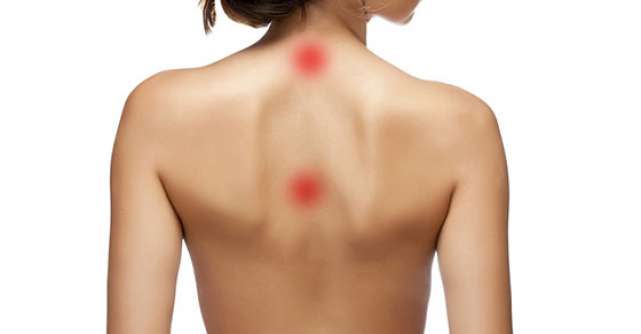 durere dureroasă la omoplați de pe spate articulațiile cervicale