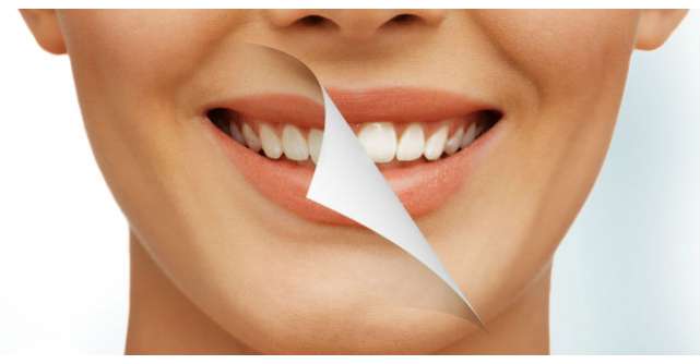 Cum iti albesti dintii foarte usor cu un ingredient ieftin