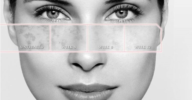  Poarta amintirile in suflet, nu pe ten!