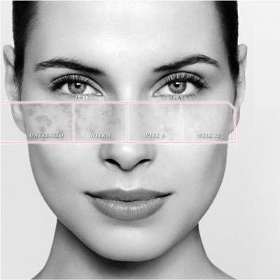  Poarta amintirile in suflet, nu pe ten!