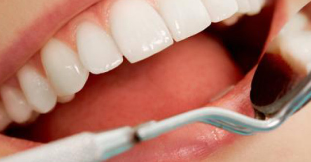 Ce trebuie sa faci pentru a ingriji un dinte devitalizat?