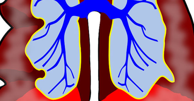 BPOC (bronhopneumopatie obstructiva cronica) 
