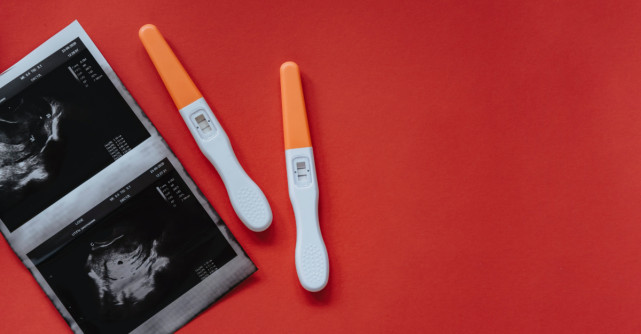 Cinci sfaturi pentru a te pregăti corect pentru o ecografie morfologică 