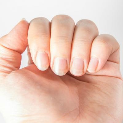 5 lucruri pe care unghiile le spun despre sanatatea ta