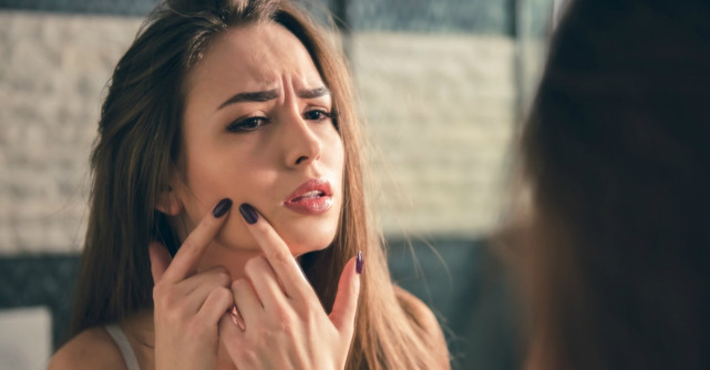 Cele mai comune mituri despre acnee 