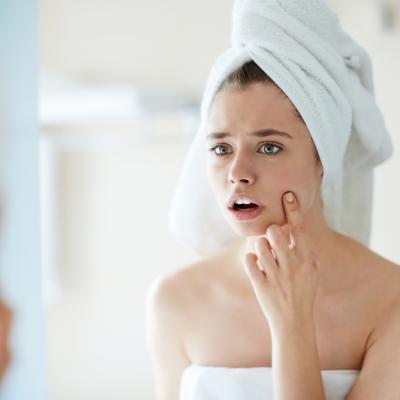 De ce nu e bine să storci coșurile? 9 motive pe care ar trebui să le iei în serios