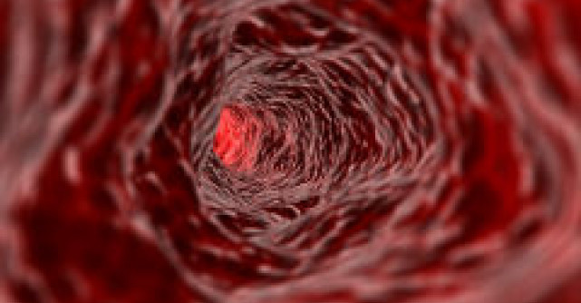 11 beneficii ale fierului in organism