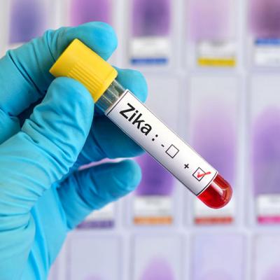 Virusul ZIKA: transmitere, simptome, tratament