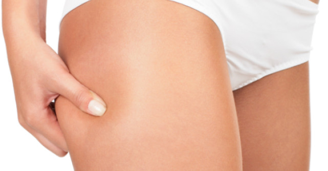 Operatia de liposuctie: Ce trebuie sa stii despre ea?