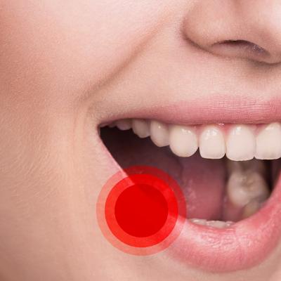 8 Cauze și factori de risc care determină apariția aftelor bucale