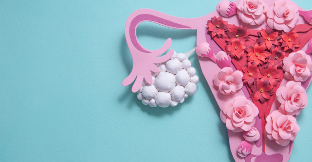 Totul despre ovarele polichistice