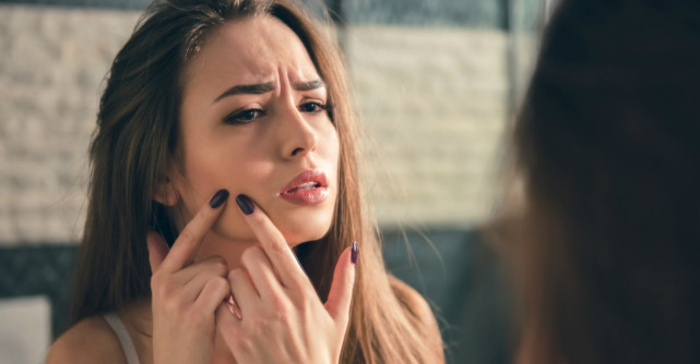 Ten acneic: cauze și soluții simple și ușor de pus în aplicare