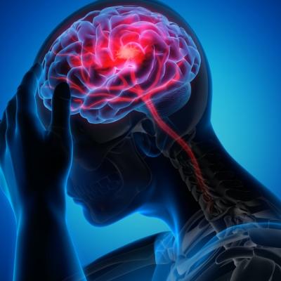 Primul ajutor în caz de accident vascular cerebral