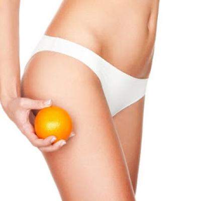 CELULITA: 5 Tratamente NATURISTE care o combat