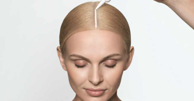 Bolile pe care le poate ascunde caderea parului