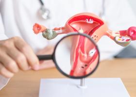 Cum se diagnostichează endometrioza: 7 investigații și teste recomandate