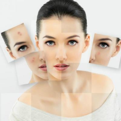 Acneea poate provoca depresie