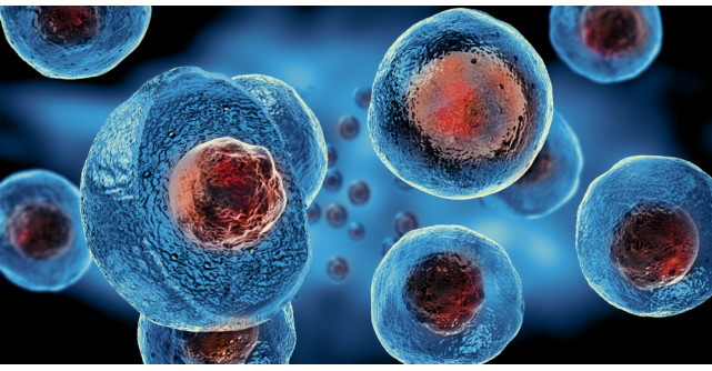 Eficiența celulelor stem în lupta cu boala Lupus