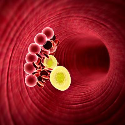 Tu cum stai cu zaharul din sange? Cum sa interpretezi rezultatele glicemiei