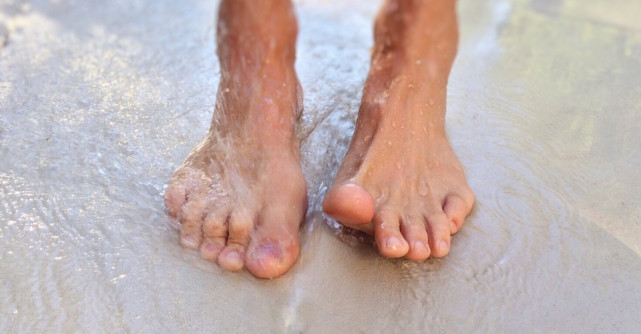 Varicele: 10 Cele mai comune cauze