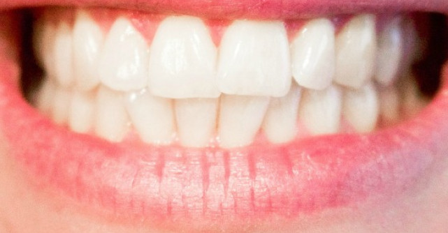 CMMP si medicii stomatologi solicita CNA aprobarea unor mesaje de avertizare privind sanatatea orala