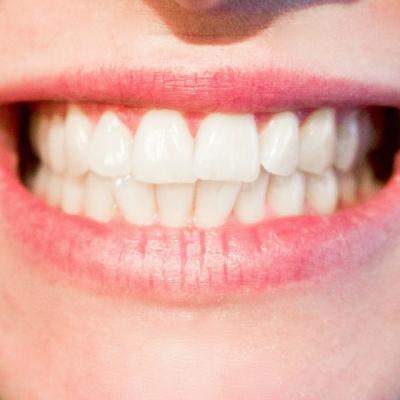 CMMP si medicii stomatologi solicita CNA aprobarea unor mesaje de avertizare privind sanatatea orala