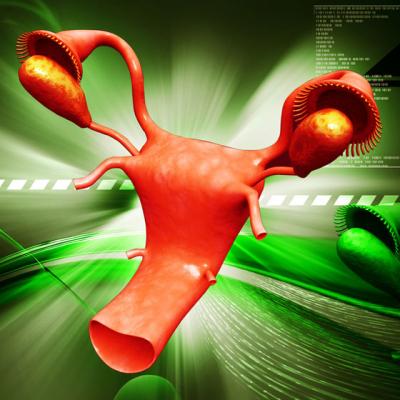 5 Tratamente naturiste pentru CHISTURI OVARIENE