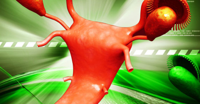 5 Tratamente naturiste pentru CHISTURI OVARIENE